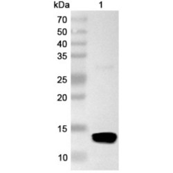 Myeloperoxidase (MPO) Antibody