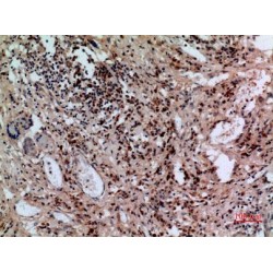 Hepatic Sodium/Bile Acid Cotransporter / NTCP (SLC10A1) Antibody