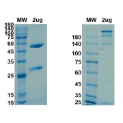 SDS-PAGE (left: reduced; right: non-reduced) analysis of SARS-CoV-2 Spike Glycoprotein Antibody.