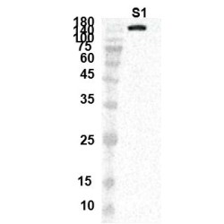 SARS-CoV-2 Spike Glycoprotein Antibody