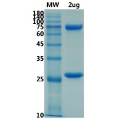 SDS-PAGE (reduced) analysis of SARS-CoV-2 Spike Glycoprotein Antibody.