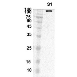 SARS-CoV-2 Spike Glycoprotein Antibody
