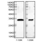 Western blot analysis of recombinant Mouse TESMIN.