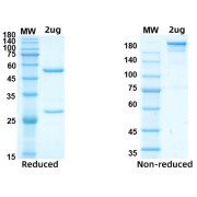 Reduced and non-reduced SDS-PAGE analysis of SARS-CoV-2/COVID-19 Nucleocapsid Protein Antibody, with Coomassie blue staining.