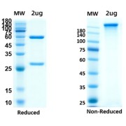Reduced and non-reduced SDS-PAGE analysis of SARS-CoV-2/COVID-19 Spike NTD Antibody, with Coomassie blue staining.