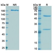 SDS-PAGE analysis of recombinant SARS-CoV-2 Spike Protein RBD (Omicron B.1.1.529 Variant) Neutralizing Antibody.