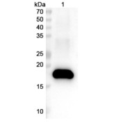 WB analysis of recombinant HPV16 E7 lysate, using HPV16 E7 antibody (0.5 μg/ml) and <a href="https://www.abbexa.com/index.php?route=product/search&amp;search=abx457668" target="_blank">abx457668</a> - Goat anti-Rabbit IgG H&L antibody conjugated to HRP (0.1 μg/ml). Calculated MW: 18 kDa, Observed MW: 18 kDa.