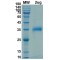 SARS-CoV-2 Spike Protein RBD (Beta B.1.351 Variant)