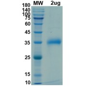 SDS-PAGE analysis of SARS-CoV-2 Spike Protein RBD (E484K Mutation).
