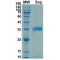 SARS-CoV-2 Spike Protein RBD (E484K Mutation)