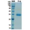 SARS-CoV-2 Spike Protein RBD (Gamma P.1 Variant)