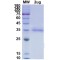 SARS-CoV-2 Spike Protein RBD (L452R Mutation)