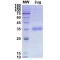 SARS-CoV-2 Spike Protein RBD (S477N Mutation)