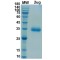 SARS-CoV-2 Spike Protein RBD (Alpha B.1.1.7 Variant)