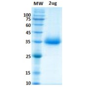 SDS-PAGE analysis of SARS-CoV-2 Spike Protein RBD (N450K Mutation).