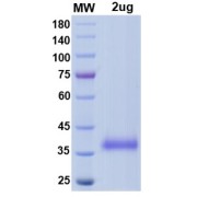 SDS-PAGE analysis of SARS-CoV-2 Spike Protein RBD (Delta B.1.617.2 Variant; L452R and T478K Mutations).