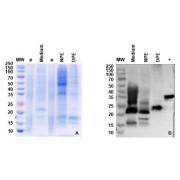 A: SDS-PAGE analysis of expression tests of the target protein using coomassie blue staining; B: WB analysis of the target protein using His-tag antibody. The negative control is marked Ø. Briefly, the bacterial cells were collected by centrifugation. The supernatant (medium) was lysed in a buffer containing PBS, pH 7.5. After centrifugation, the soluble supernatnant fraction was collected (native protein extraction - NPE). The insoluble fraction was collected and solubilized with a denaturing buffer (8 M Urea). After centrifugation, the supernatant was collected (denatured protein extraction - DPE). The NPE and DPE fractions were analyzed by SDS-PAGE. The target genes were transfected in HEK293 cells, 1.5 ml of culture medium and cells were collected on 6th day of post-transfection. After semi-purification, the optimal expression was observed in cultutre medium, NPE and DPE fraction.
