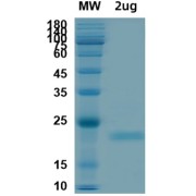 SDS-PAGE anlaysis of recombinant SARS-CoV-2 Envelope Protein.
