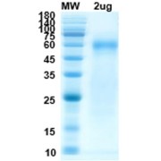 SDS-PAGE analysis of SARS-CoV-2 Nucleocapsid Protein.