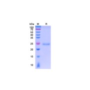 SDS-PAGE analysis of SARS-CoV-2 S Protein RBD