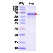 SDS-PAGE analysis of Human Eosinophil Peroxidase (EPX) Protein.