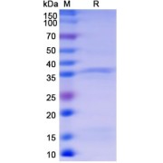 SDS-PAGE analysis of Monkeypox Virus B5R Protein.