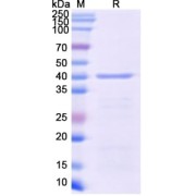SDS-PAGE analysis of Monkeypox Virus C19L Protein.