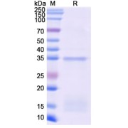 SDS-PAGE analysis of Monkeypox Virus D13L Protein.