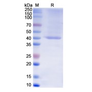 SDS-PAGE analysis of recombinant Monkeypox Virus B2R Protein.