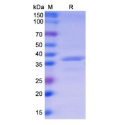 SDS-PAGE analysis of Monkeypox Virus A44R (MPXV A44R) Protein.