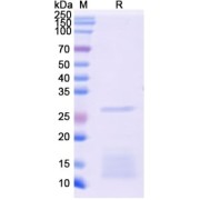 SDS-PAGE analysis of recombinant Monkeypox Virus H3L Protein.