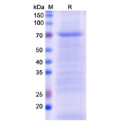 SDS-PAGE analysis of Monkeypox Virus EEV Maturation Protein (MPXV C18L) protein.