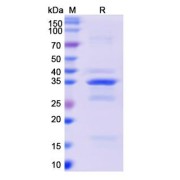 SDS-PAGE analysis of recombinant Monkeypox Virus A26L (MPXV A26L) Protein.