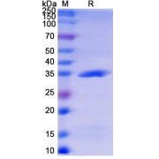 SDS-PAGE analysis of recombinant Monkeypox Virus A27L Protein.