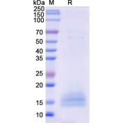 SDS-PAGE analysis of recombinant Monkeypox Virus A35R Protein.