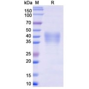 SDS-PAGE analysis of recombinant Monkeypox Virus E8L Protein.
