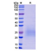 SDS-PAGE analysis of recombinant Monkeypox Virus M1R Protein.