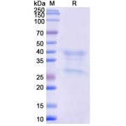 SDS-PAGE analysis of Monkeypox Virus H3L Protein.