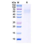 SDS-PAGE analysis of recombinant Monkeypox Virus Hemagglutinin (MPXV B2R) Protein.