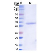 SDS-PAGE analysis of Monkeypox Virus B6R Protein.