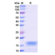 SDS-PAGE analysis of Monkeypox Virus L1R (MPXV L1R) protein.
