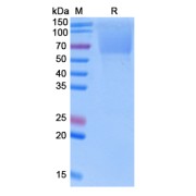SDS-PAGE analysis of recombinant Human Guanylyl Cyclase C (GUCY2C) Protein.