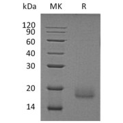 SDS-PAGE analysis of recombinant Human Activin Receptor Type-1 (ACVR1) Protein.