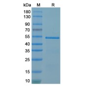 SDS-PAGE analysis of recombinant Andes Orthohantavirus Glycoprotein C (ANDV Gc) Protein.