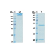 SDS-PAGE analysis of Lebrikizumab.