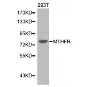 Western blot analysis of extracts of 293T cell line, using MTHFR antibody.