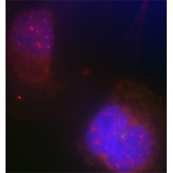 Breast Cancer Type 1 Susceptibility Protein Phospho-Ser988 (BRCA1 pS988) Antibody
