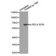 Western blot analysis of extracts from HepG2 cells, using Phospho-RELA-S536 antibody.