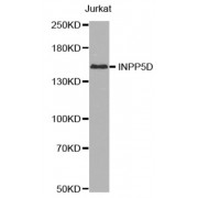 Western blot analysis of extracts of Jurkat cell line, using INPP5D antibody.