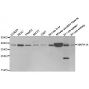 Western blot analysis of extracts of various cell lines, using MAPK14 antibody.